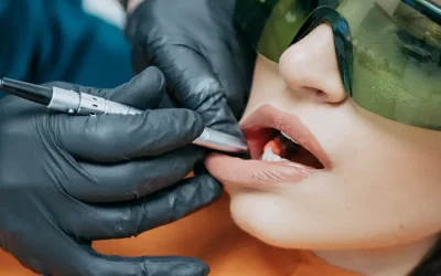 Sbiancamento dentale: rischi e benefici