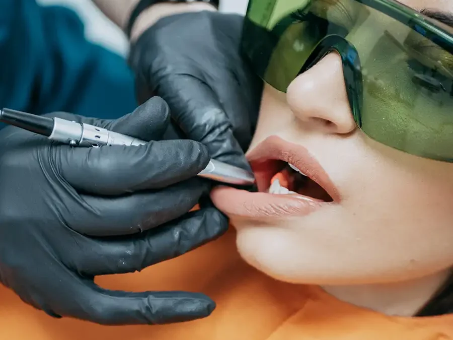 Sbiancamento dentale: rischi e benefici